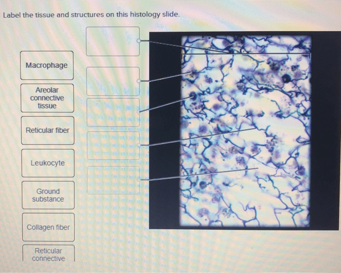 Label the tissue and structures on this histology slide