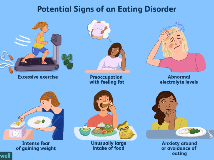 Characteristics of anorexia nervosa include all of the following except: