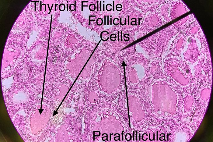 Label the tissue and structures on this histology slide